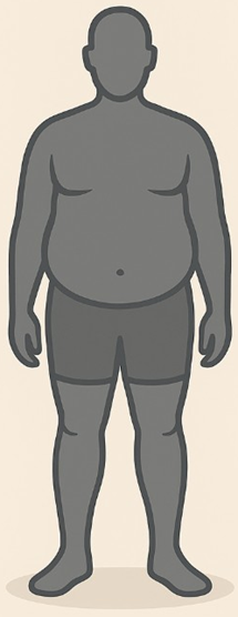 Surpoids facteur de risques